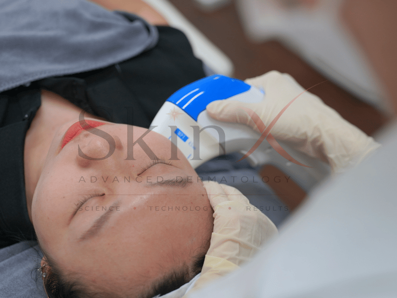 Với sự linh hoạt nhiều đầu típ, có thể sử dungj trên nhiều vùng cơ thể 